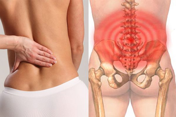 Chẩn đoán bệnh lúc bị đau lưng