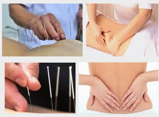 Châm cứu chữa trị mỏi lưng
