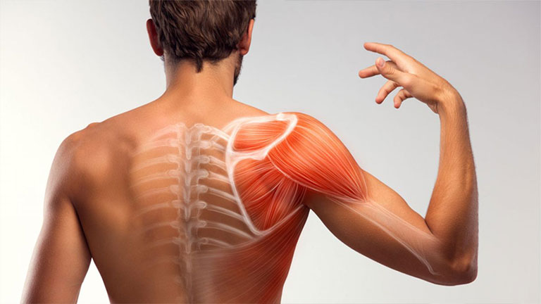 Đau lưng dưới bả vai bên phải là bệnh gì