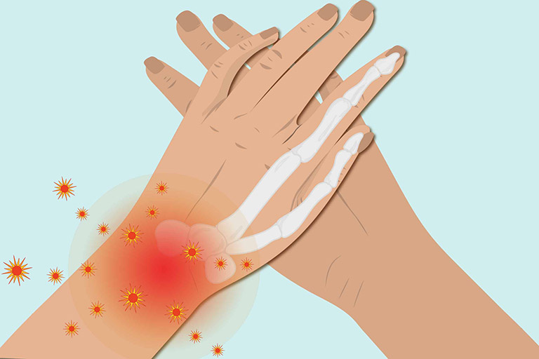 Chẩn đoán bệnh viêm khớp cổ tay bằng cách nào