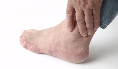 Viêm khớp cổ chân bắt buộc ăn gì?