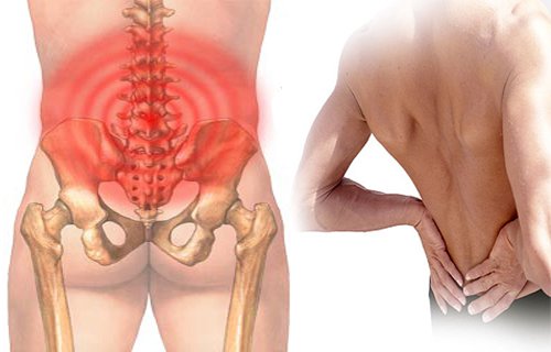 Dấu hiệu nhận biết bệnh viêm khớp cùng chậu