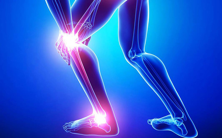 Giải pháp ngăn ngừa đau xương bánh chè