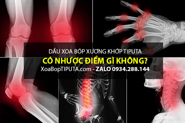 Ưu nhược điểm của Rượu xoa bóp nhức mỏi xương khớp