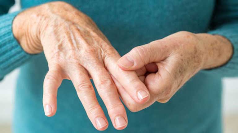 Các mã gen liên quan đến viêm khớp dạng thấp