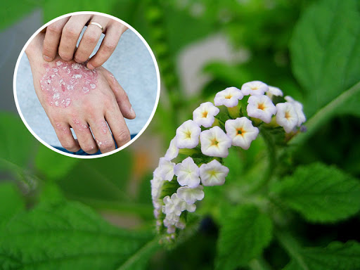 Dùng cây vòi voi chữa trị viêm da cơ địa bằng cách uống