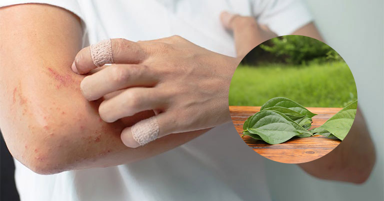 Lá trầu không có thể làm thuốc bôi