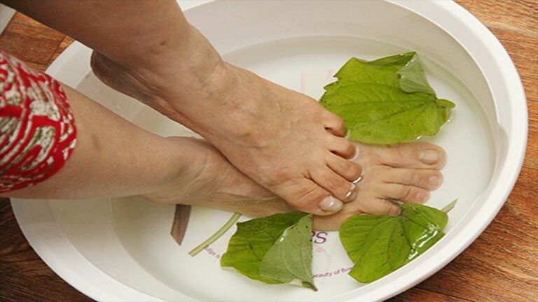 Chữa viêm da cơ địa bằng bài thuốc ngâm rửa nước lá bàng
