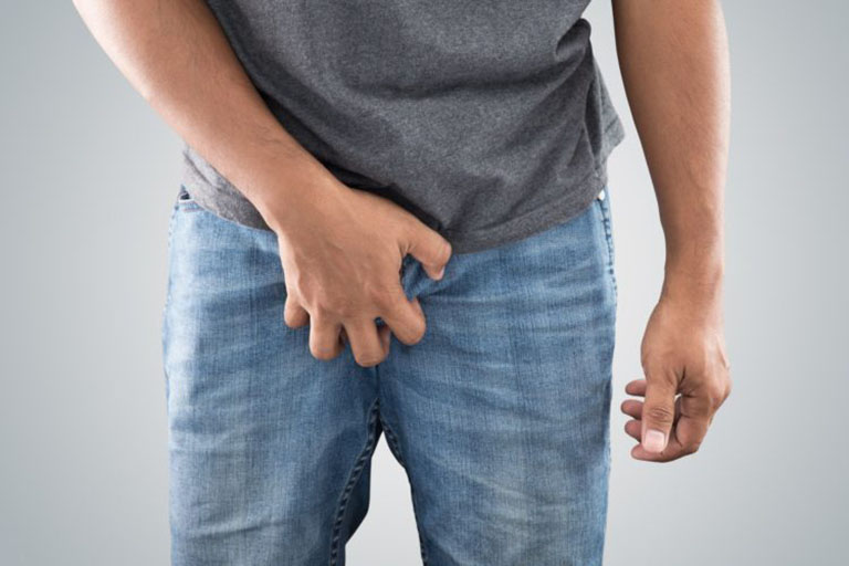viêm da cơ địa ở vùng kín