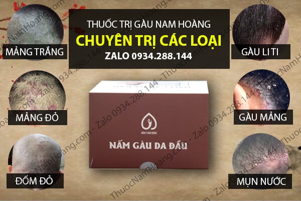 Thuốc điều trị gàu hiệu quả Nam Hoàng: