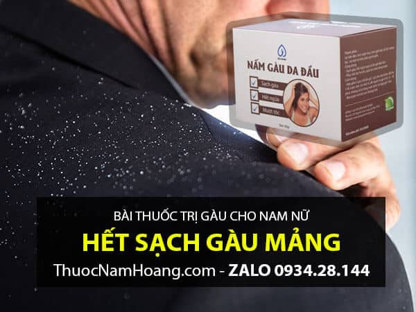bài thuốc trị gàu dứt điểm