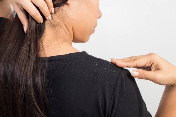 Bà bầu mắc gàu có bình thường hoặc không