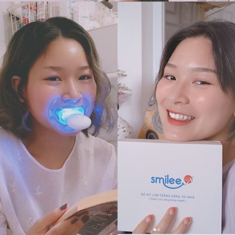 Bộ kit trắng răng Smilee có tốt không
