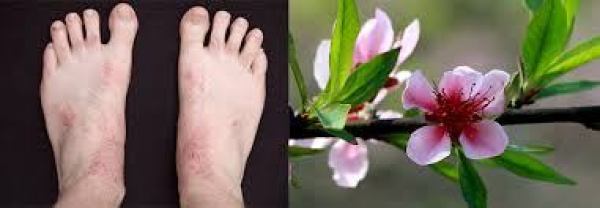 lá đào được dùng chữa bệnh tổ đỉa