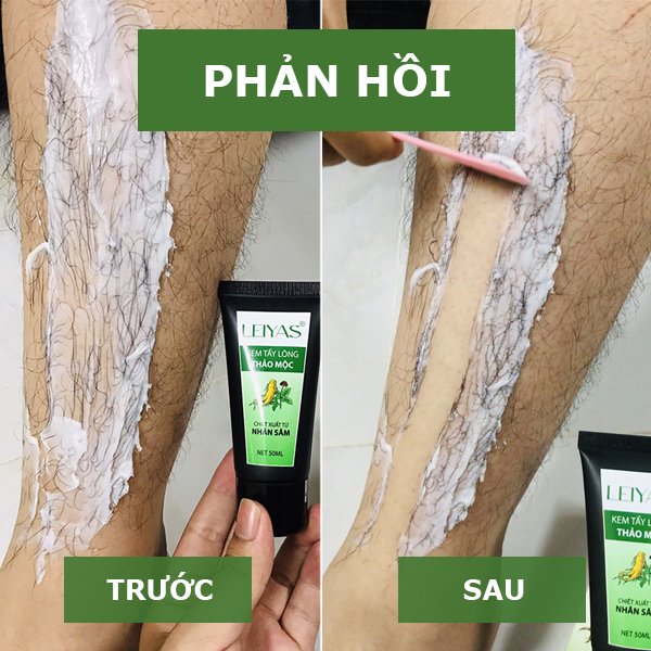 Thế mạnh của kem triệt lông Leiyas