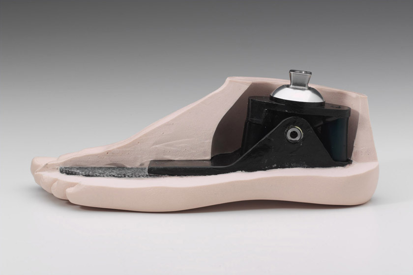 Single Axis Foot WillowWood Prosthetic Feet