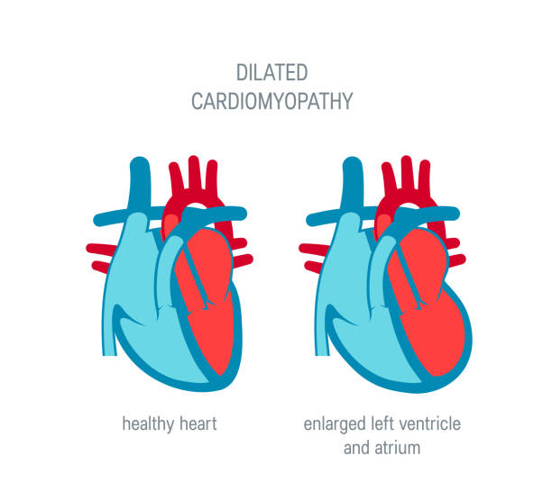 Heart disease vector concept in flat illustration style 