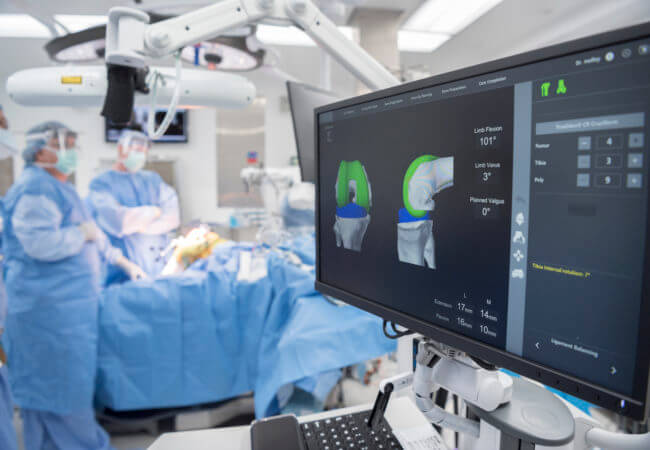 Robotic-arm assisted hip replacement surgery