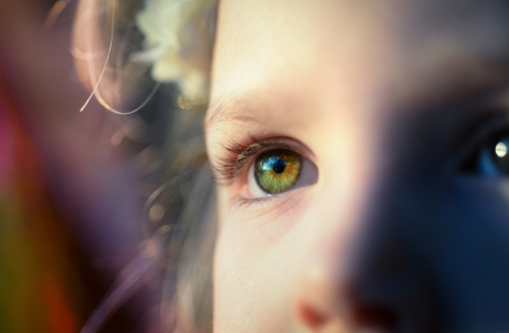 Close up of a child with epilepsy and autism's eye