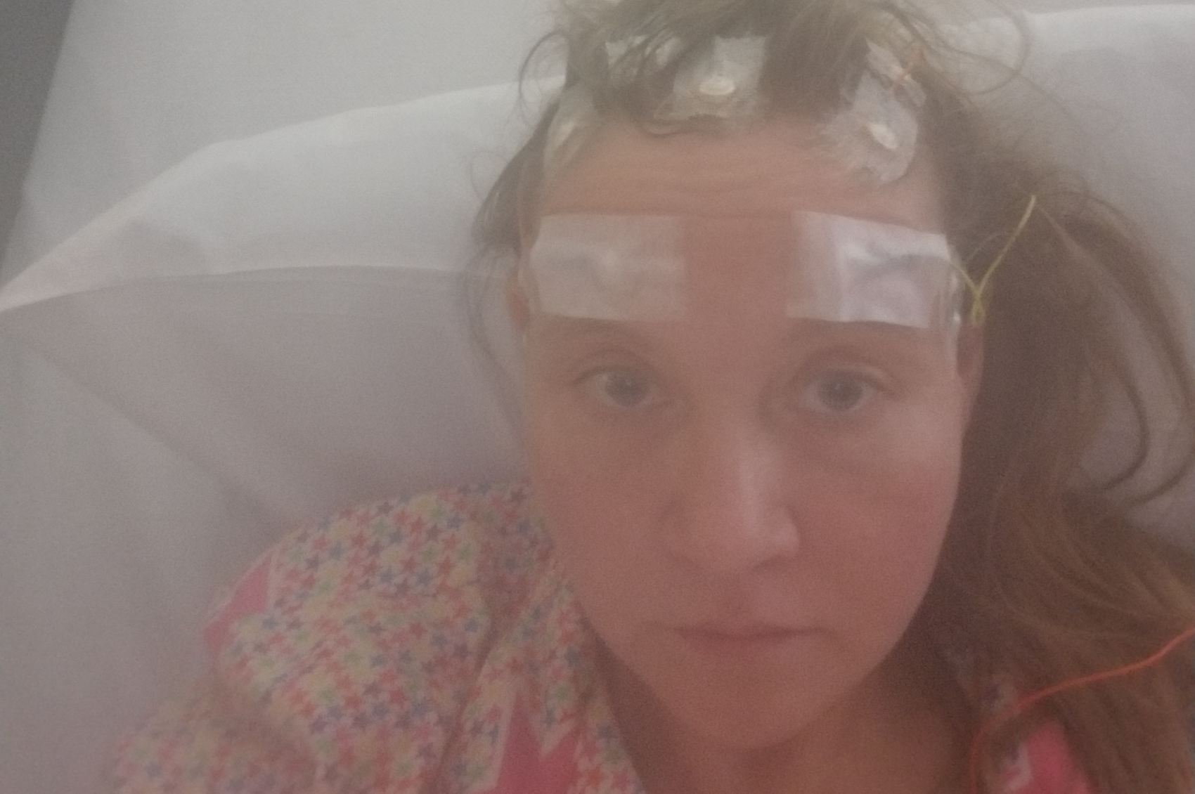 Tiffany having an epilepsy EEG