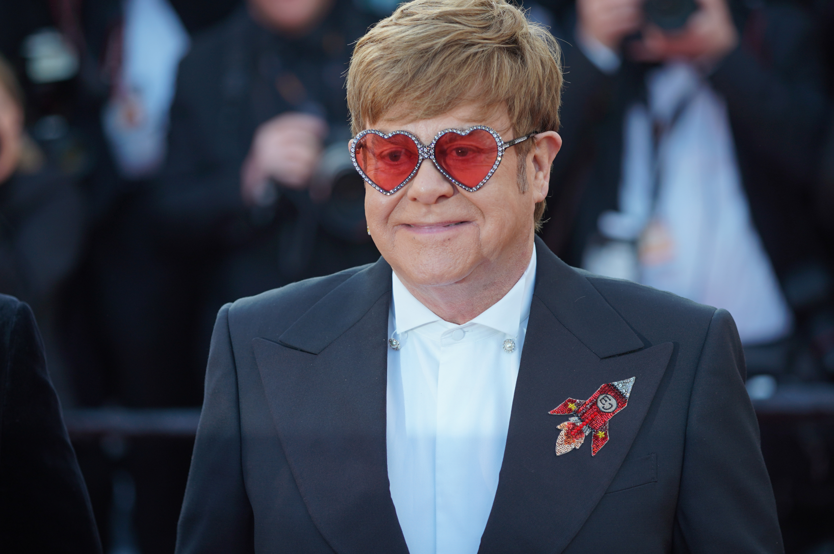 Elton John lives with epilepsy