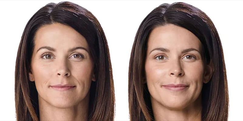 Before & After