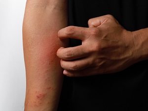 A person scratching an itch on their arm.