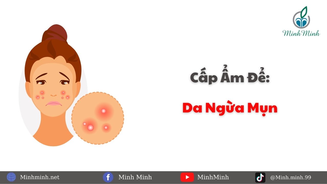 Cấp ẩm giúp da ngừa mụn