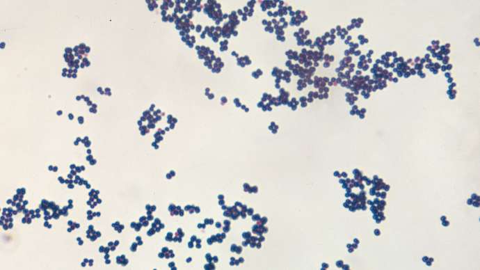 Staphylococcus aureus; food poisoning