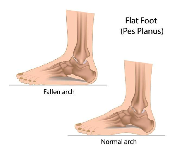 Benefits of Barefoot Shoes: A Beginners Guide