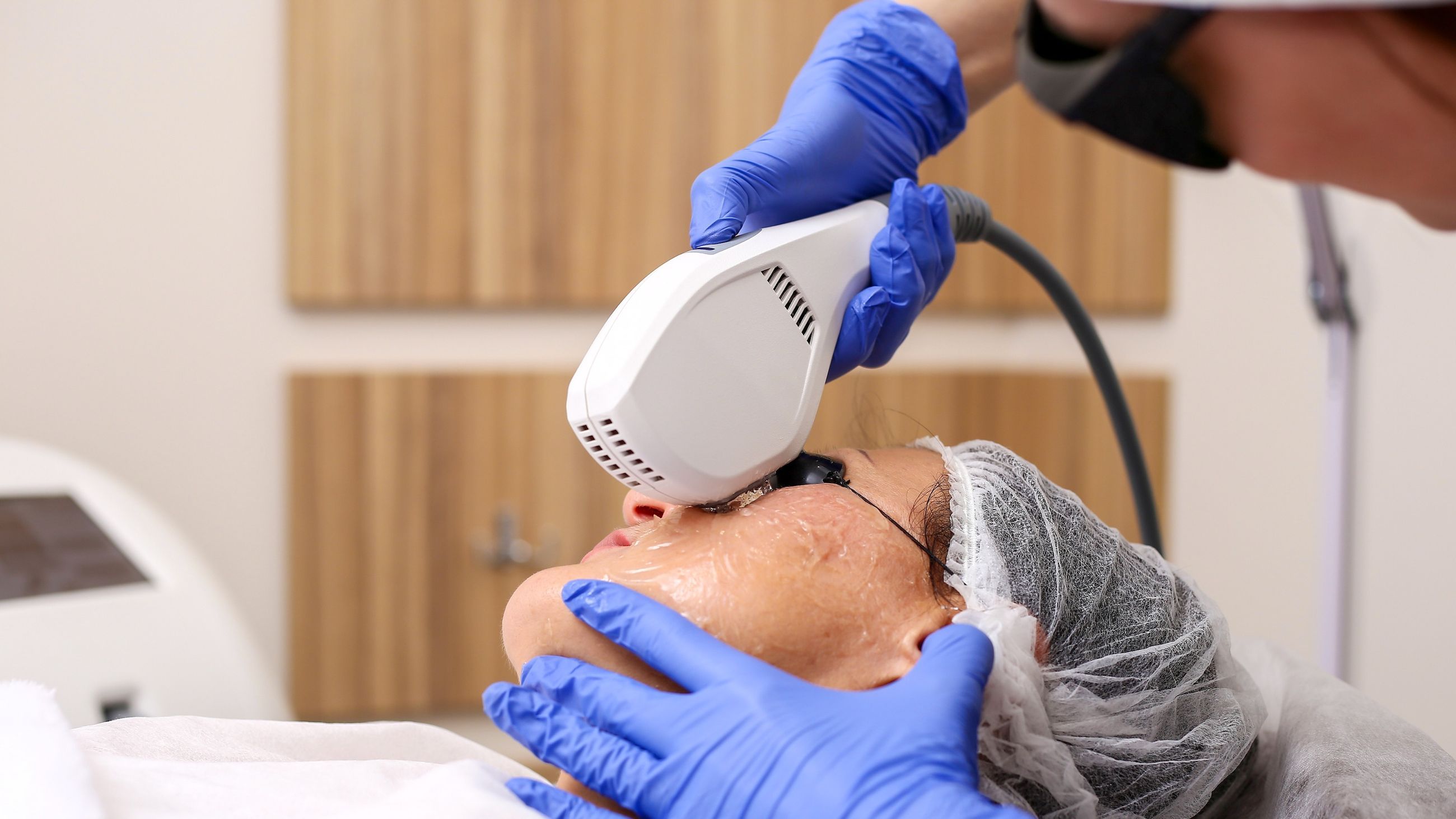 IPL for broken capillaries Spot Check skin cancer + aesthetics. Melbourne CBD