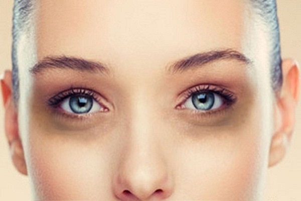 trị thâm mắt bằng laser có tốt không