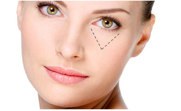 trị thâm quầng mắt bằng laser giá bao nhiêu
