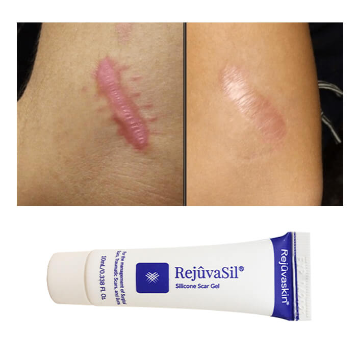 Scar Rejuvasil 10ml