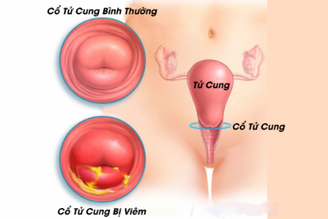 Khám phụ khoa ở Vĩnh Phúc