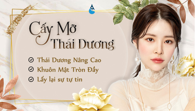 Cấy mỡ thái dương là gì?