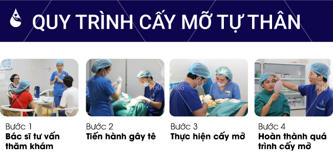 Quy trình cất mỡ thái dương