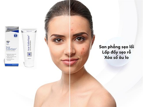 Kem trị sẹo scar esthetique có trị được sẹo lồi không 3