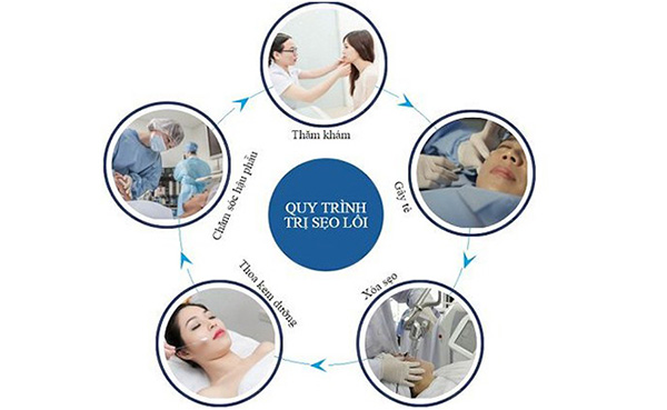 xóa sẹo lồi giá bao nhiêu