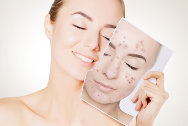 bệnh thủy đậu bao lâu thì hết lây