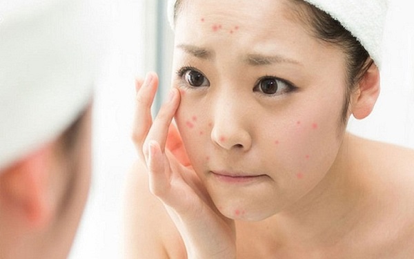 Scar Esthetique mua ở đâu hà nội 4
