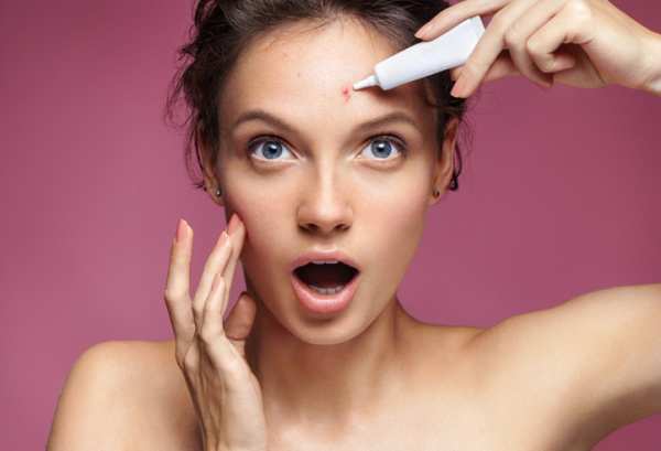 nặn mụn đúng cách không để lại sẹo