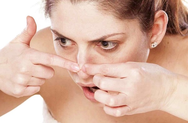 Bị mụn cám có nên nặn không?