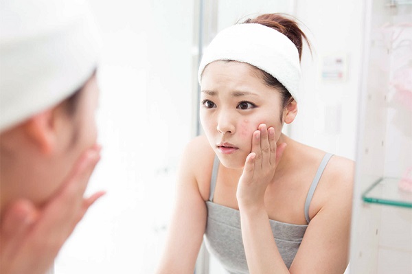 nặn mụn xong có nên bôi serum