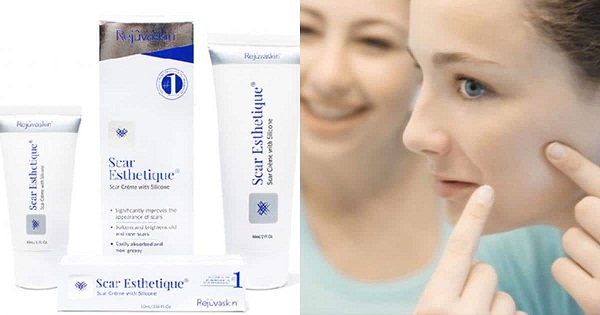 Kem trị sẹo scar esthetique có trị được mụn không 3