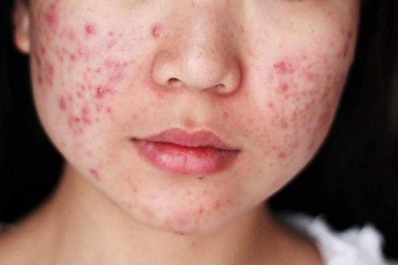 Người phụ nữ dễ mắc bệnh phụ khoa, tử cung 'yếu' thường sẽ có 3 đặc điểm ở miệng - 3