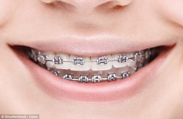 Những tai nạn 'chuyện ấy' tưởng đùa mà có thật khiến bác sĩ ngỡ ngàng, chào thua