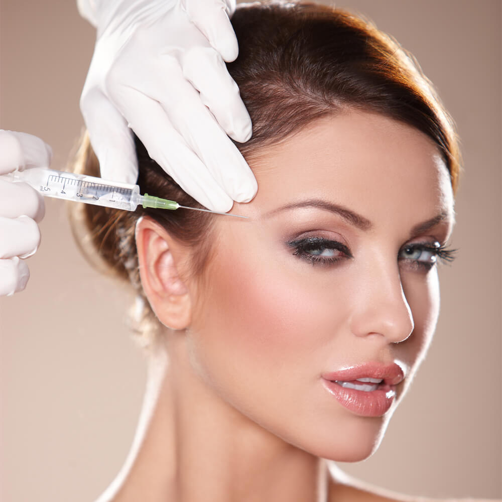 độn thái dương bằng tiêm filler