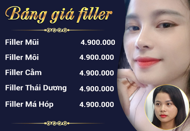 tiêm filler cằm V line , tiêm filler cằm bao nhiêu tiền