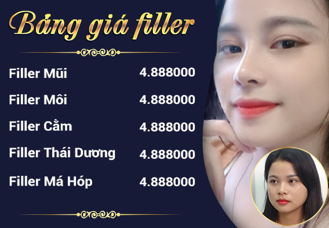 tiêm filler cằm giá bao nhiêu , chi phí tiêm filler cằm